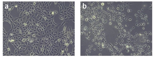 How To Thaw Cells Guide For More Reproducible Cryopreservation