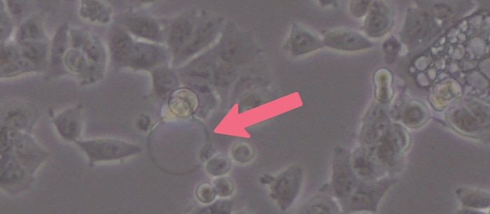 Microscopic image of an adherent cell culture after seeding. Cells close to the air bubble in the center of the image kept their round shape indicating missing cell attachment to the growth surface.