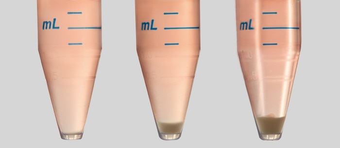 Three conical tubes show various degrees of cell sedimentation depending on the time since they have been filled with a cell suspension.