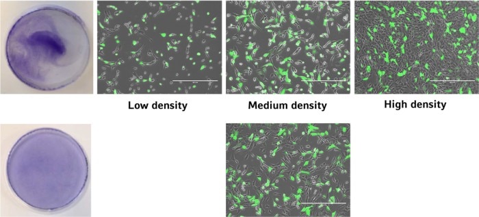 Microscopic images with fluorescent overlay of GFP-transfected cells in different vessel locations. The transfection efficiency differs depending on the cell density.