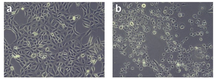 Normal and abnormal shape of Vero cells by variation in cell thawing.